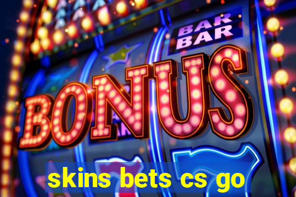 skins bets cs go