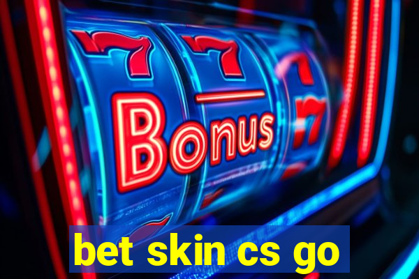 bet skin cs go